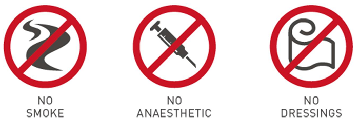 No Smoke, No Anaesthetic, no dressings.